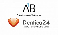 Implantoprotetyka jako alternatywa dla tradycyjnych protez zębowych - Serwis informacyjny z Wodzisławia Śląskiego - naszwodzislaw.com