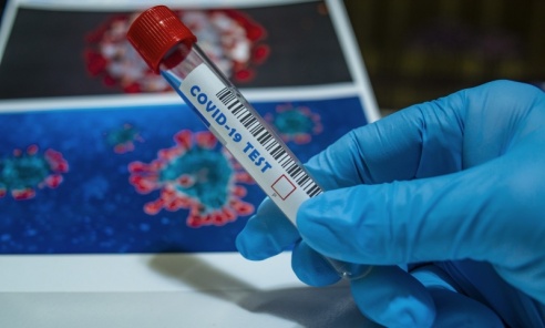 NFZ: od 1 kwietnia zmienią się zasady zlecania i wykonywania testów na koronawirusa - Serwis informacyjny z Wodzisławia Śląskiego - naszwodzislaw.com