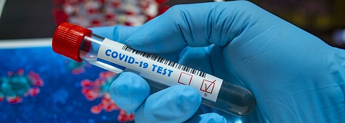MZ rozszerzyło krąg lekarzy mogących zlecić badanie w kierunku koronawirusa - Serwis informacyjny z Wodzisławia Śląskiego - naszwodzislaw.com