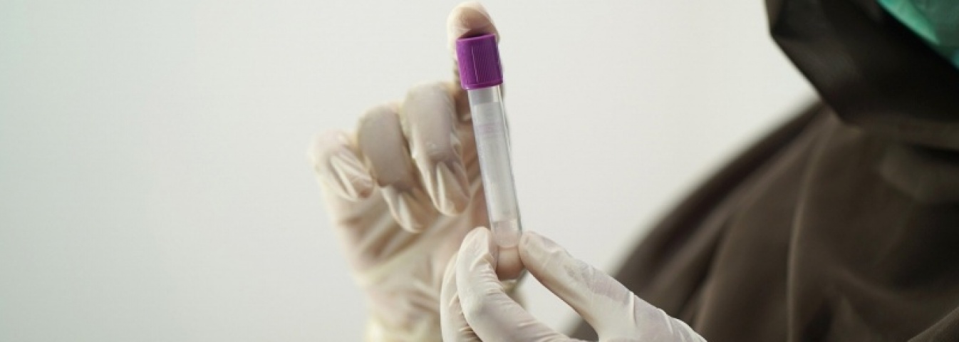 Testy antygenowe będą wykorzystywane do stwierdzania koronawirusa obok testów PCR - Serwis informacyjny z Wodzisławia Śląskiego - naszwodzislaw.com